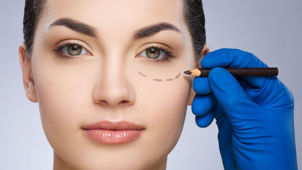 eye lid surgery bakersfield 2