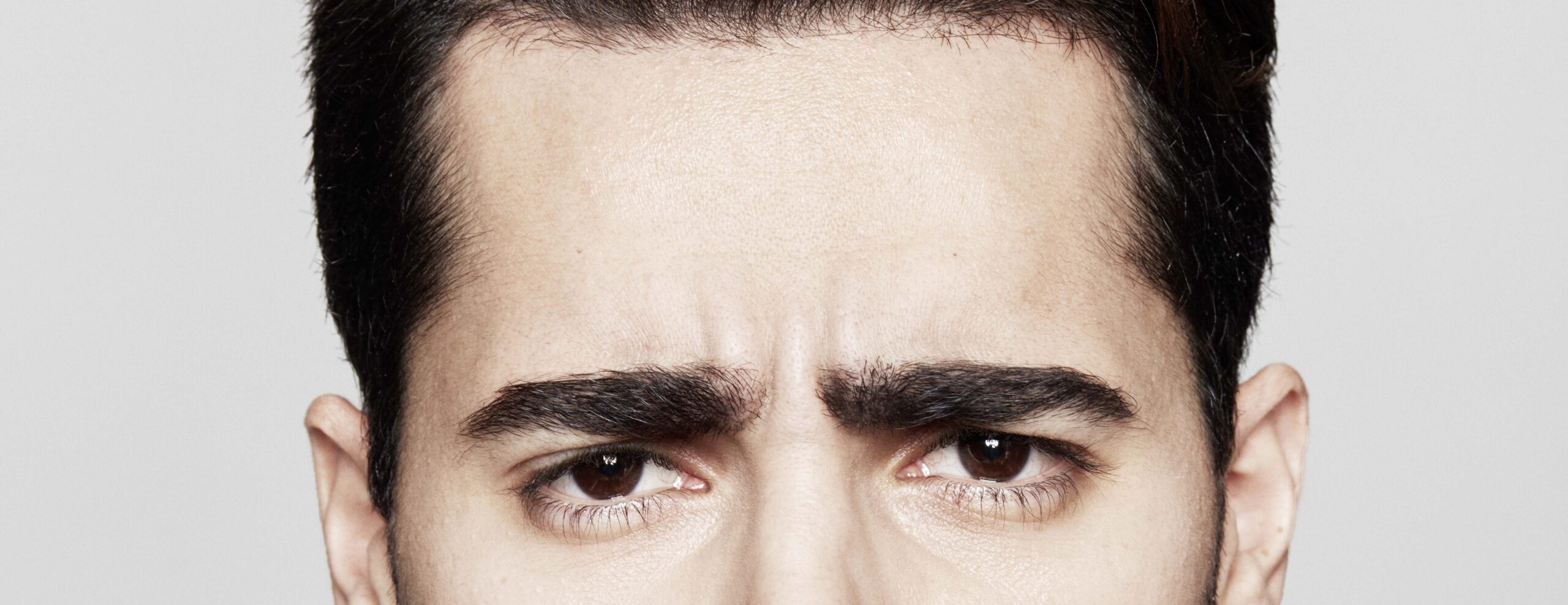 Woman's forehead and brow showing the muscles that a Botox brow lift relaxes to lift the brow
