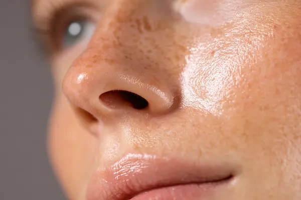 Close-up of healthy facial skin showing smooth texture, even tone and natural luminosity after aesthetic treatment