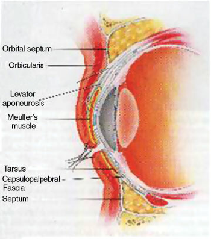 Detailed anatomical diagram showing under-eye structure including fat compartments, tear trough area, and skin layers in Bakersfield patient consultation